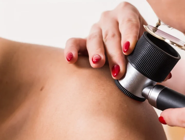 dermatoscopie alunite Integria Medical Cluj